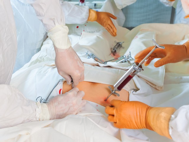 Bone Marrow Transplant