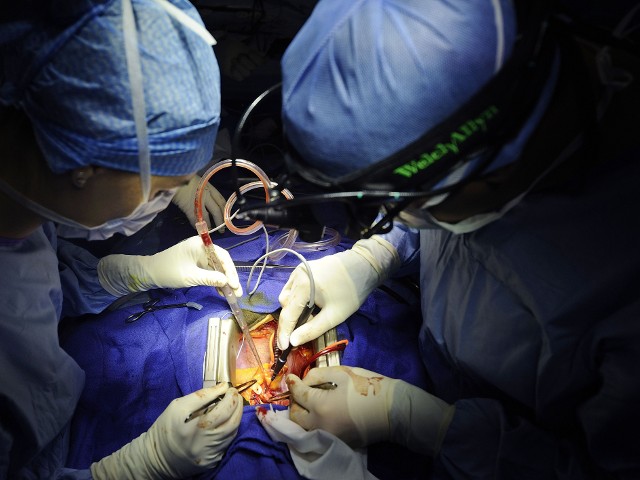 Heart Surgery