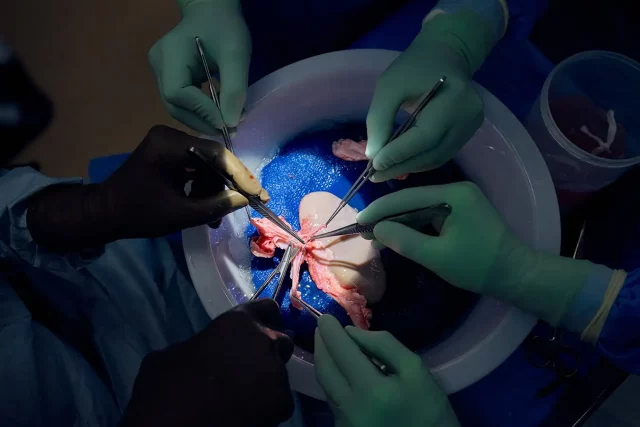 Kidney Transplant