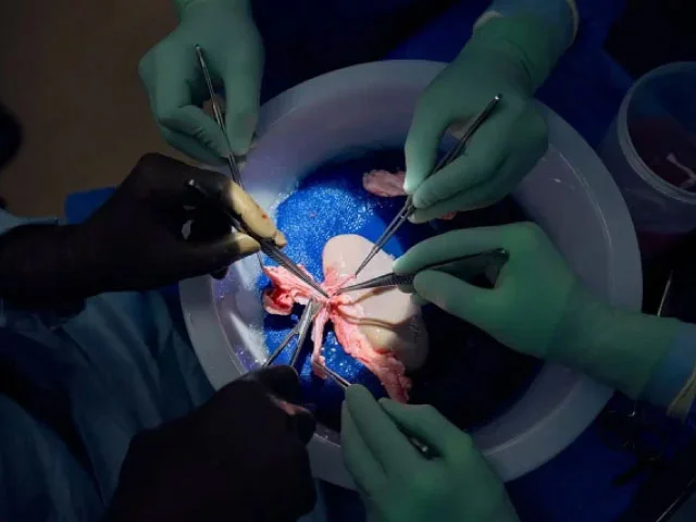 Kidney Transplant Possibilities: Hope for a Brighter Future