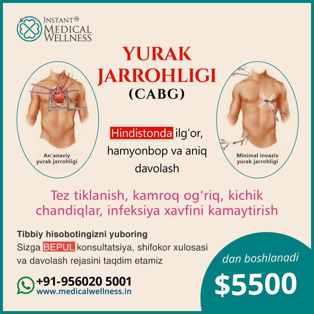 iMW-post_CABG_Uzbekistanijpg iMW-post_CABG_Uzbekistanijpg